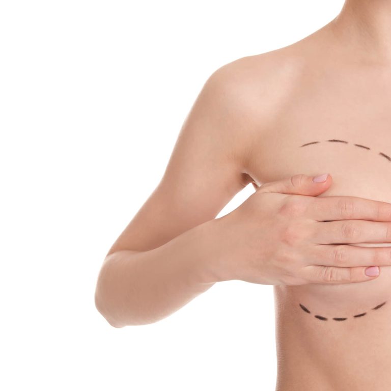 10 CRITICAL FACTS TO UNDERSTAND BEFORE CHOOSING BREAST REDUCTION QATAR image (1)